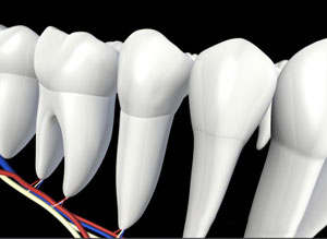 Healed Tooth