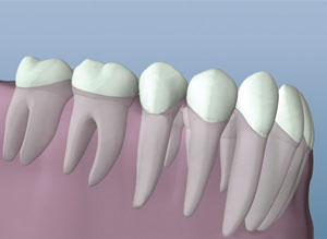 Root Canal Therapy Healthy Tooth