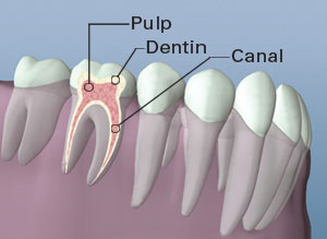 Root Canal Therapy Anatomy