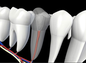 Tooth Filling restored