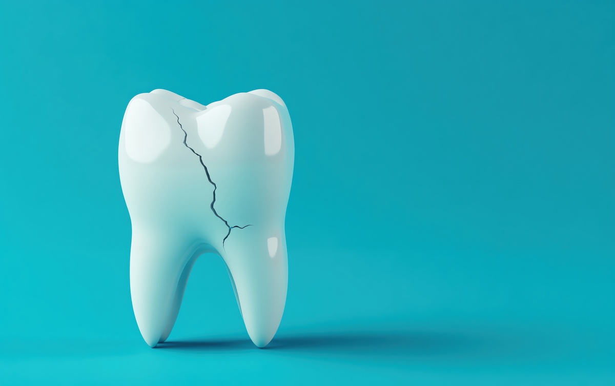 A cracked tooth on a vibrant blue background representing dental health issues.