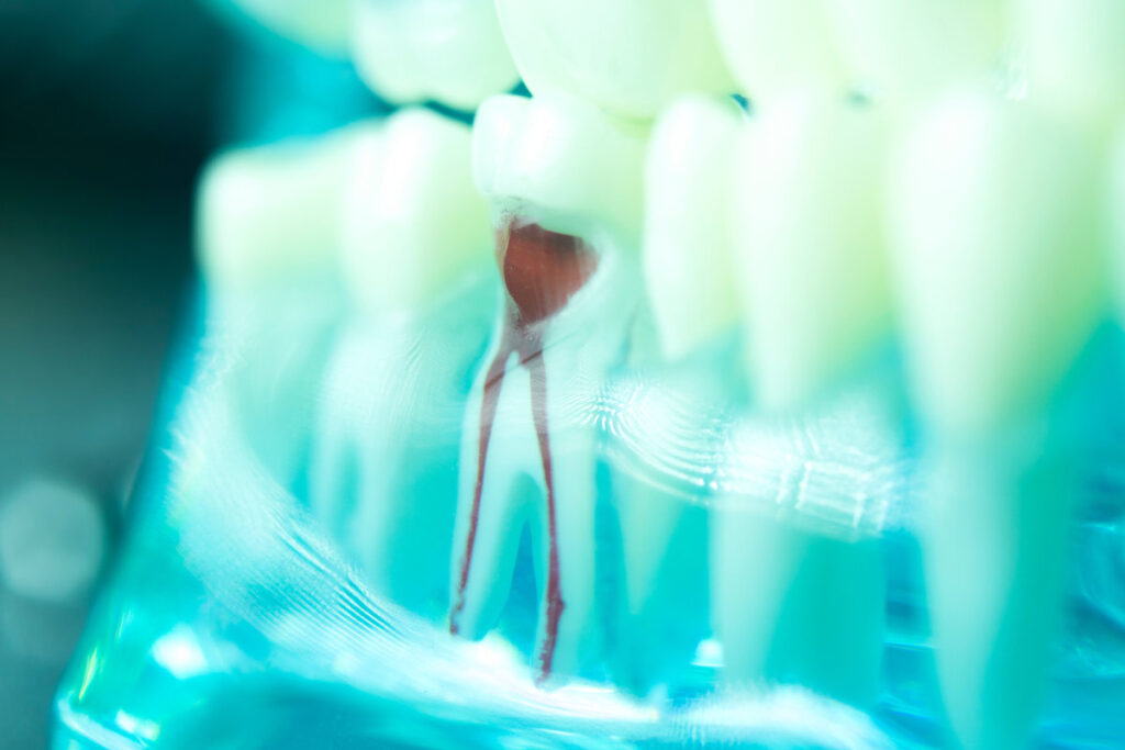 Dental tooth root canal dentists teeth model closeup.